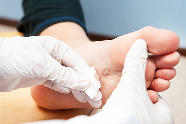 Diabetic-Foot-Surgery